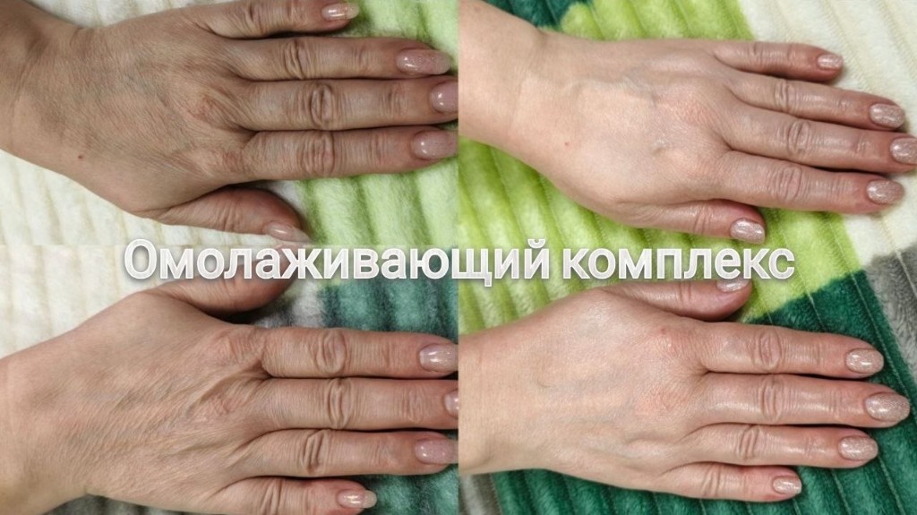 Эстетическая косметология, работа 7 — омолаживающий комплекс для рук